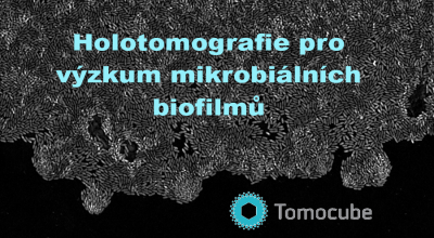 Holotomografie pro výzkum mikrobiálních biofilmů
