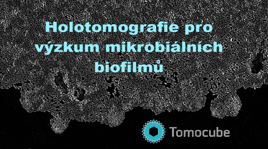 Holotomografie pro výzkum mikrobiálních biofilmů
