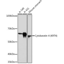Cytokeratin 4 (KRT4) Rabbit mAb