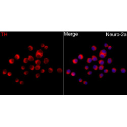 Tyrosine Hydroxylase Rabbit pAb