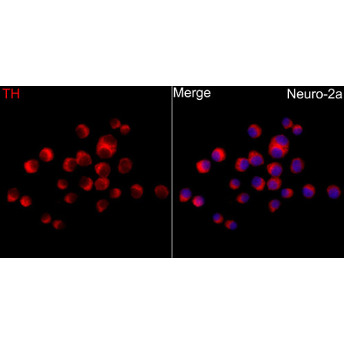 Tyrosine Hydroxylase Rabbit pAb