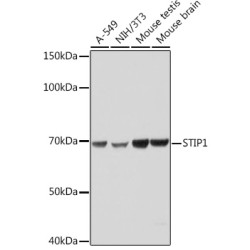 STIP1 Rabbit mAb