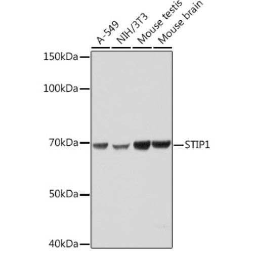 STIP1 Rabbit mAb