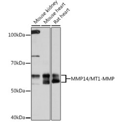 MMP14/MT1-MMP Rabbit mAb