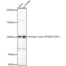 Integrin beta 3 (ITGB3/CD61) Rabbit pAb