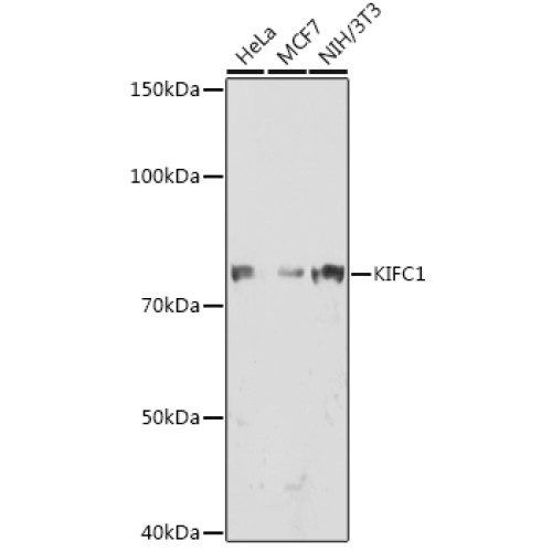 KIFC1 Rabbit mAb