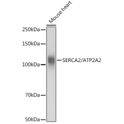 SERCA2/ATP2A2 Rabbit pAb
