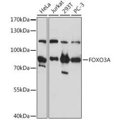 FOXO3A Rabbit pAb