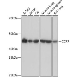 CCR7 Rabbit mAb