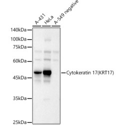 Cytokeratin 17 (KRT17) Rabbit pAb