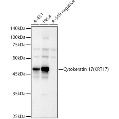 Cytokeratin 17 (KRT17) Rabbit pAb