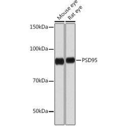 PSD95 Rabbit mAb
