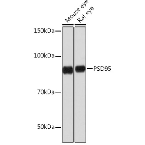 PSD95 Rabbit mAb