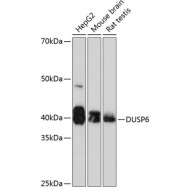 DUSP6 Rabbit mAb