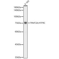 TRMT2A/HTF9C Rabbit mAb