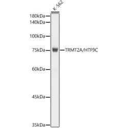TRMT2A/HTF9C Rabbit mAb