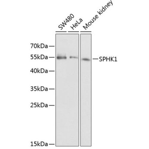 SPHK1 Rabbit pAb