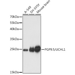 PGP9.5/UCHL1 Rabbit pAb