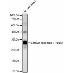 Cardiac Troponin I (TNNI3) Rabbit pAb