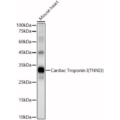 Cardiac Troponin I (TNNI3) Rabbit pAb