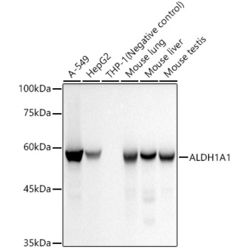 ALDH1A1 Rabbit mAb