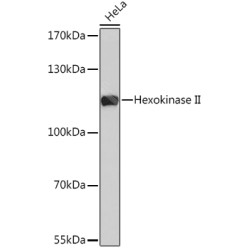 Hexokinase II Rabbit pAb