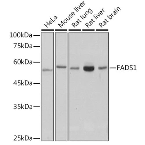 FADS1 Rabbit mAb