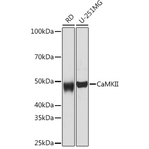 CaMK2 delta/CAMK2 gamma Rabbit mAb