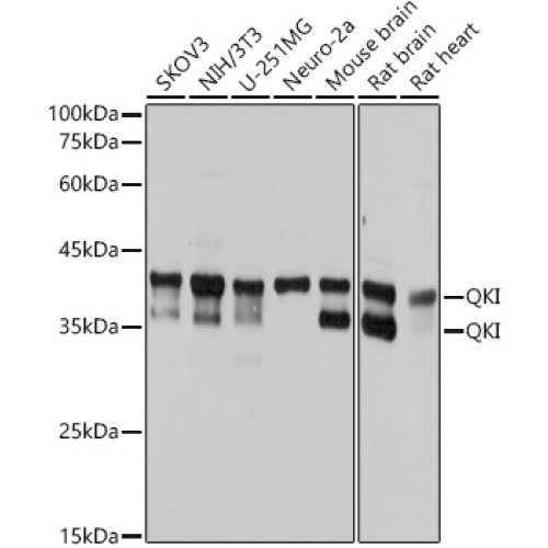 QKI Rabbit mAb