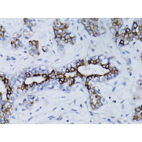 BRCA1 Rabbit pAb