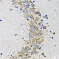 CDK1 Rabbit pAb