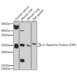 C-Reactive Protein (CRP) Rabbit pAb