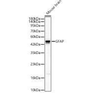 GFAP Rabbit pAb