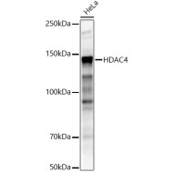 HDAC4 Rabbit pAb