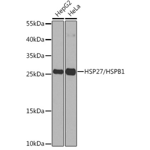 HSP27/HSPB1 Rabbit pAb