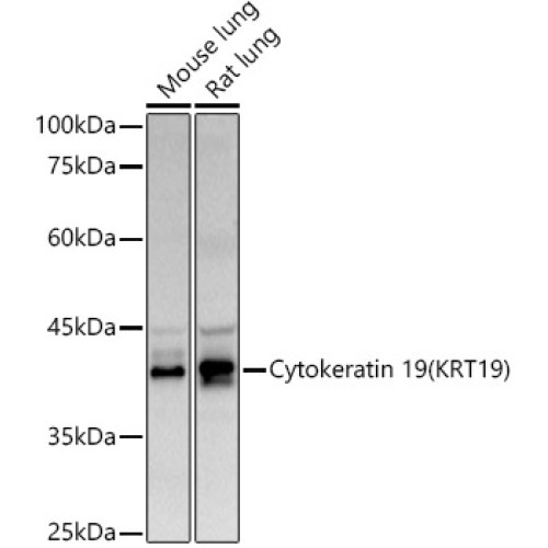 Cytokeratin 19 (KRT19) Rabbit pAb