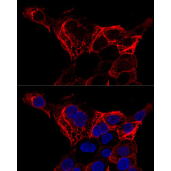 Cytokeratin 20 (KRT20) Rabbit pAb