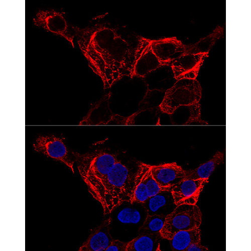 Cytokeratin 20 (KRT20) Rabbit pAb