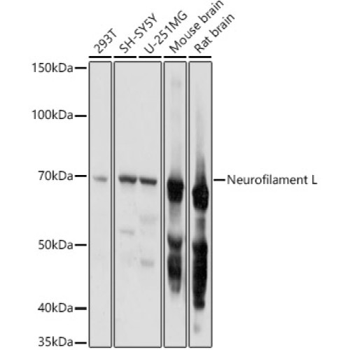 Neurofilament L Rabbit pAb