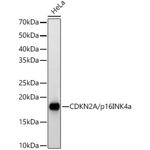 [KO Validated] CDKN2A/p16INK4a Rabbit pAb