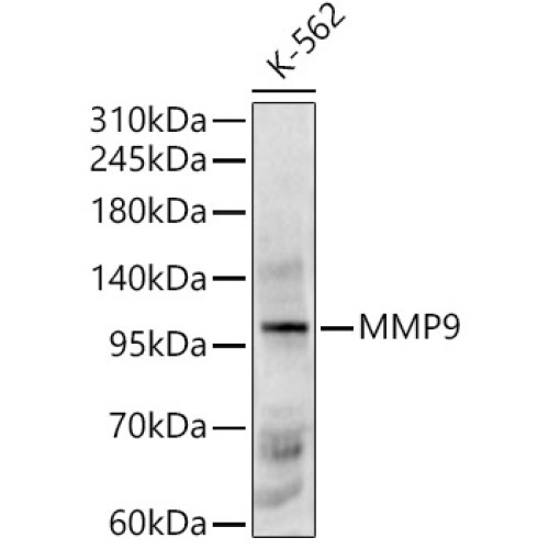 MMP9 Rabbit pAb