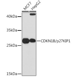 CDKN1B/p27KIP1 Rabbit pAb