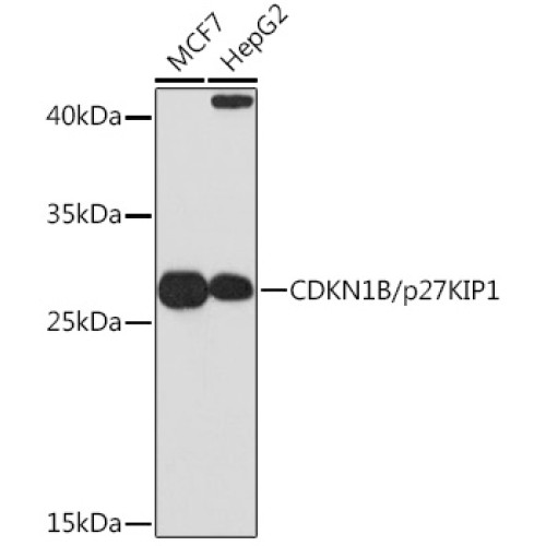 CDKN1B/p27KIP1 Rabbit pAb