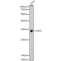 [KO Validated] CDK2 Rabbit pAb
