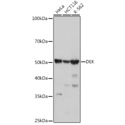 DEK Rabbit mAb