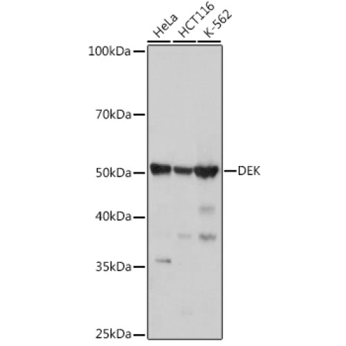 DEK Rabbit mAb