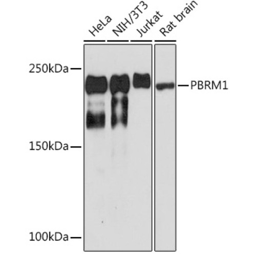 PBRM1 Rabbit mAb