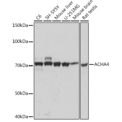 ACHA4 Rabbit mAb