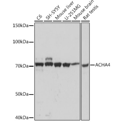 ACHA4 Rabbit mAb