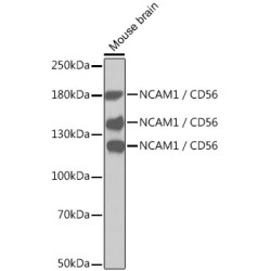NCAM1 / CD56 Rabbit pAb